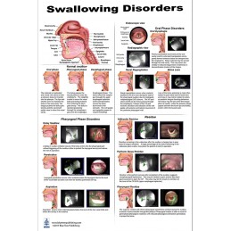 Swallowing Large Poster set - swallowing disorders