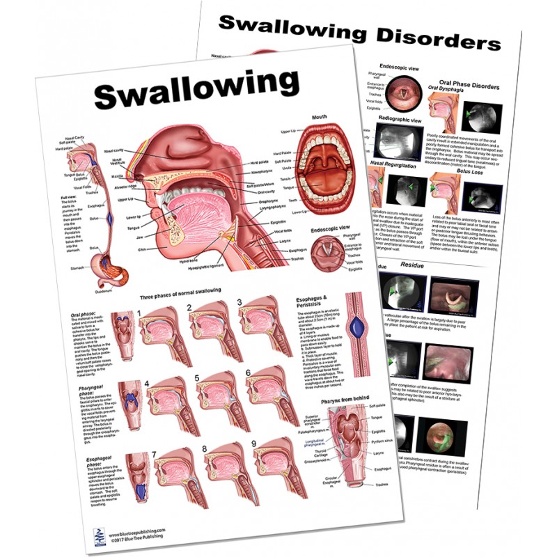 Swallowing Large Poster set