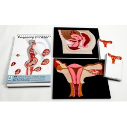 Pregnancy Flip Charts Two Models and Stick Note Set