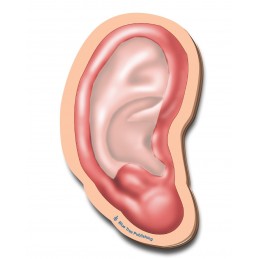 Outer ear stick note