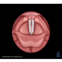 Scan the QR code next to the vocal folds and see it come to life