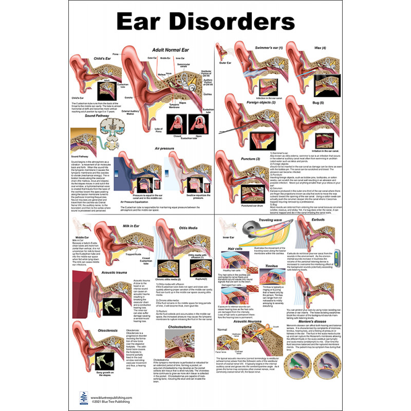 Ear Disorders Large Poster