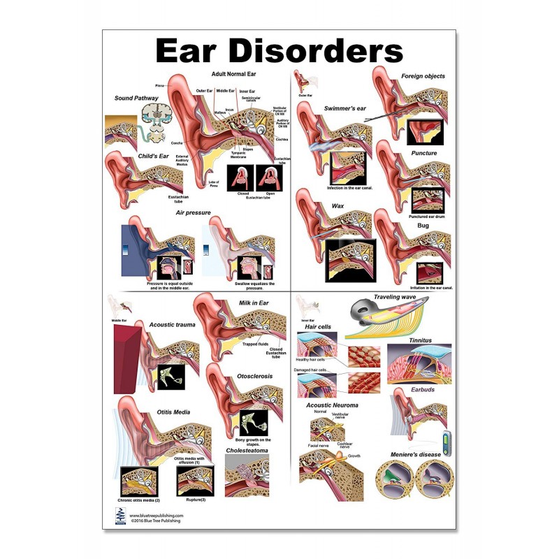 Ear Disorders Regular Poster