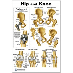 Hip and Knee Large Poster